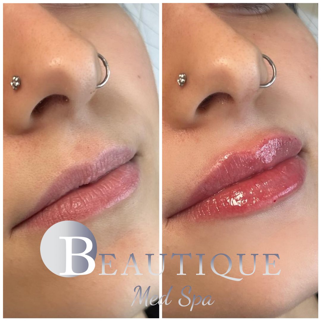 Beautique Med Spa Barrie - Hair Salon in Barrie