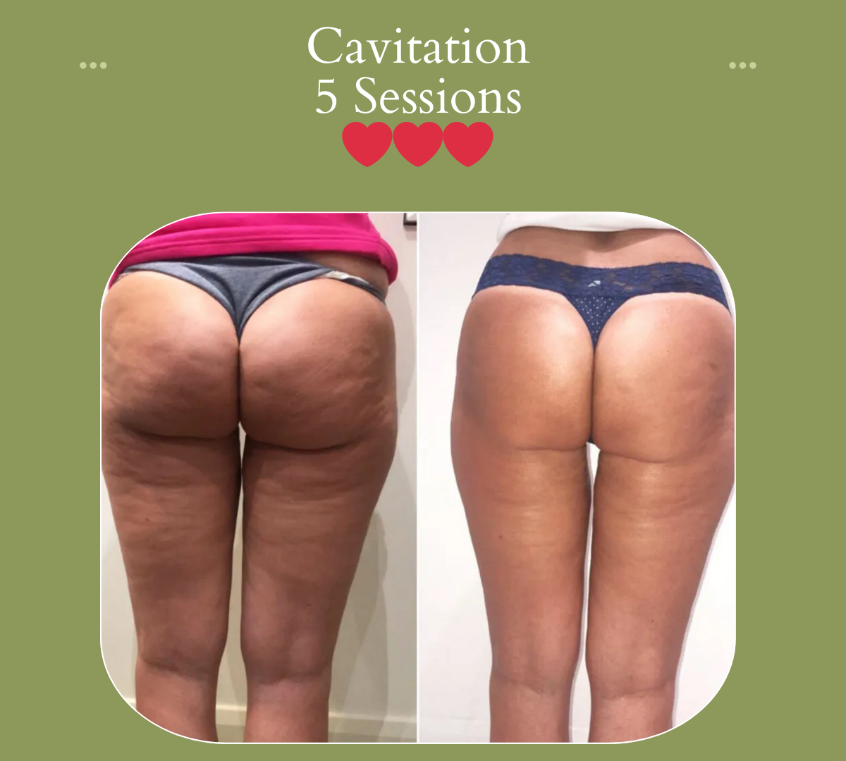 Beauty Genie Spa - Beauty Spa in Calgary