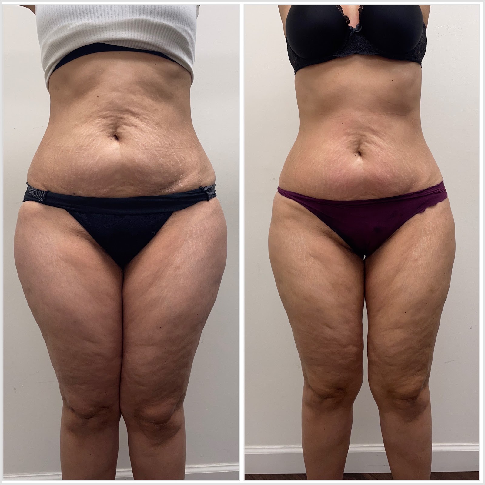 Skinfidence Az - Beauty Spa in Tempe