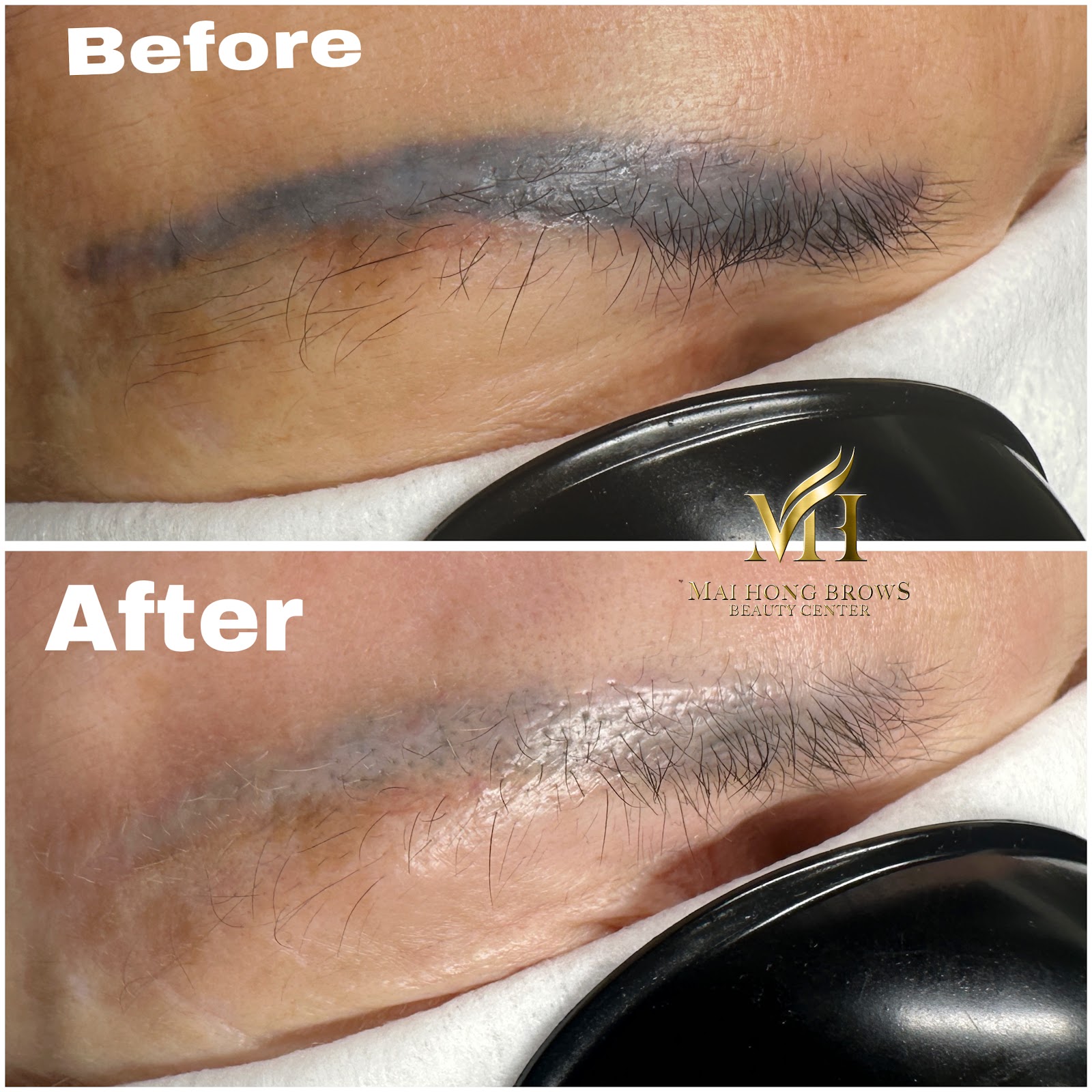 MH Beauty - Beauty Spa in San Jose