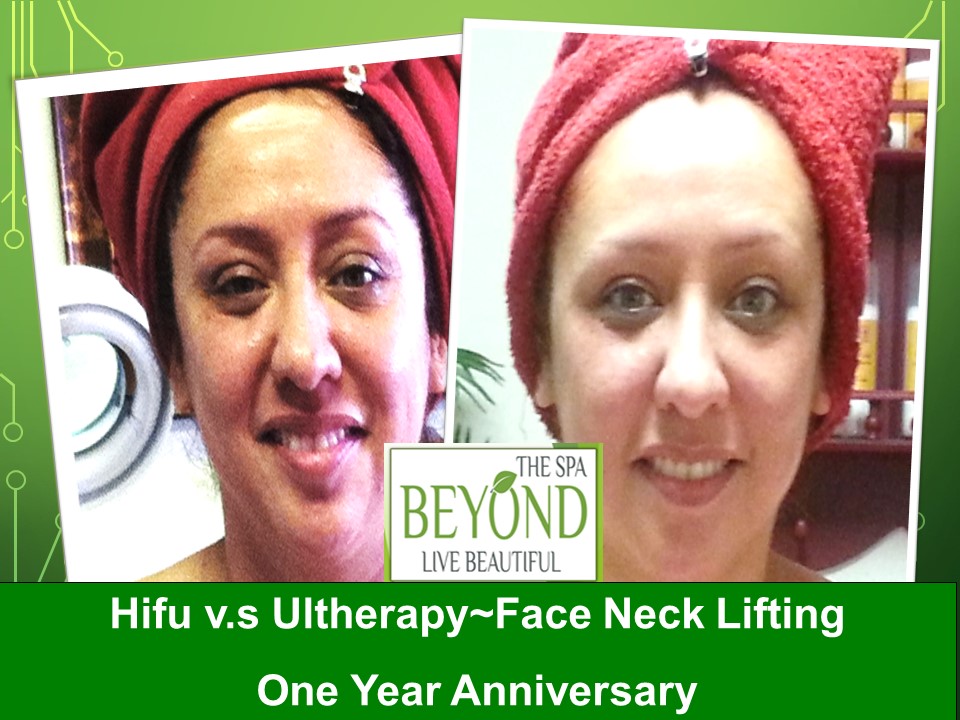 Beyond The Spa is #1 Specialized in HIFU-Ultherapy Trail: $499 - Beauty Spa in San Jose