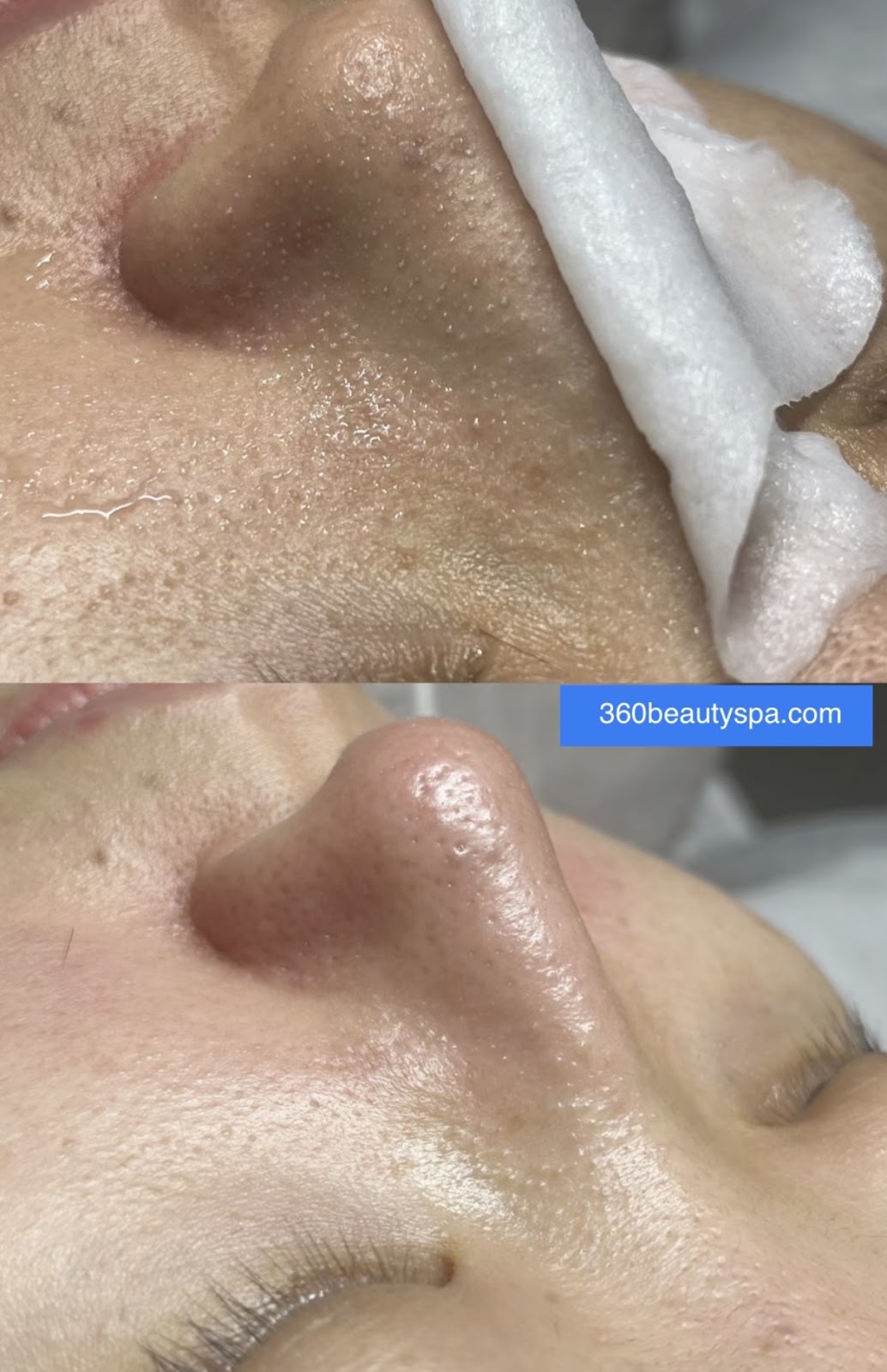 360 Beauty Spa - Beauty Spa in San Jose