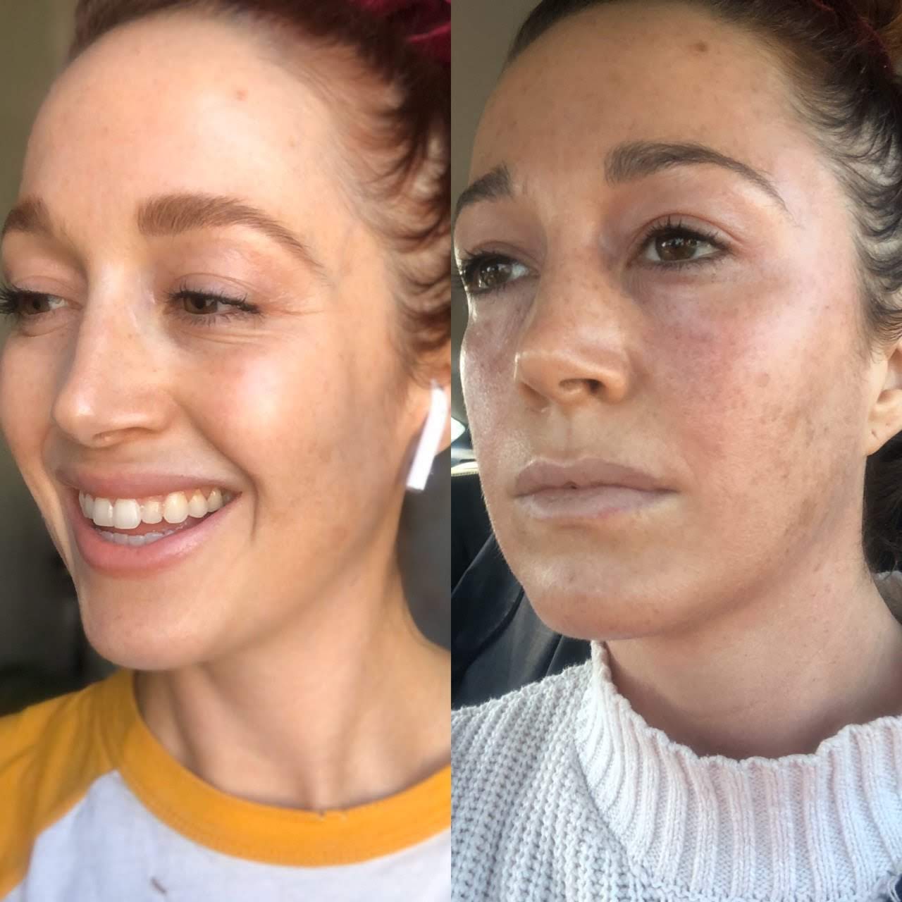 Derma Spa - Beauty Spa in Riverside