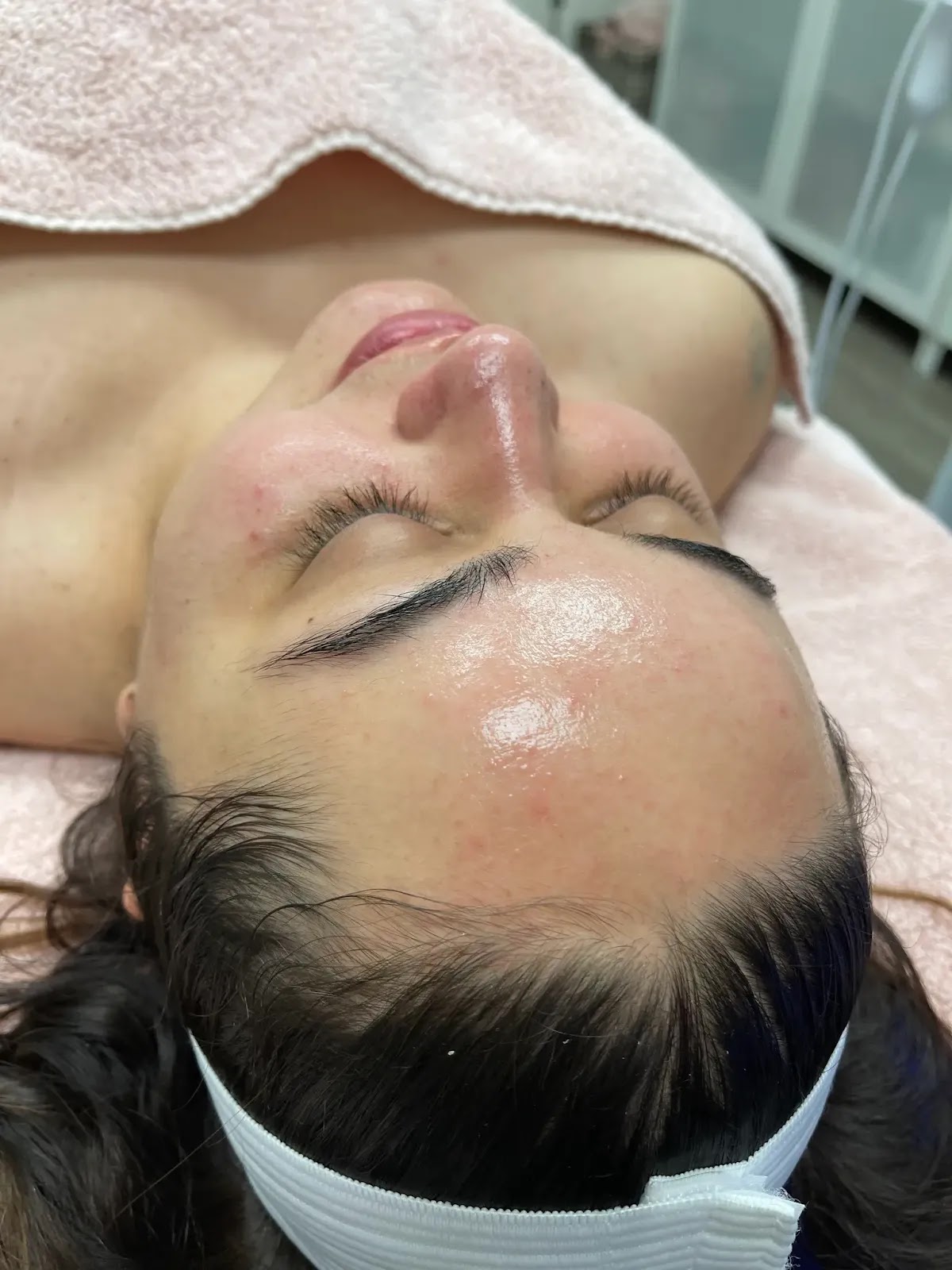 Skintastic Medi Spa - Botox in Riverside | Med Spa Riverside | Hydrafacial Riverside | Lip Fillers Riverside, California - Beauty Spa in Riverside
