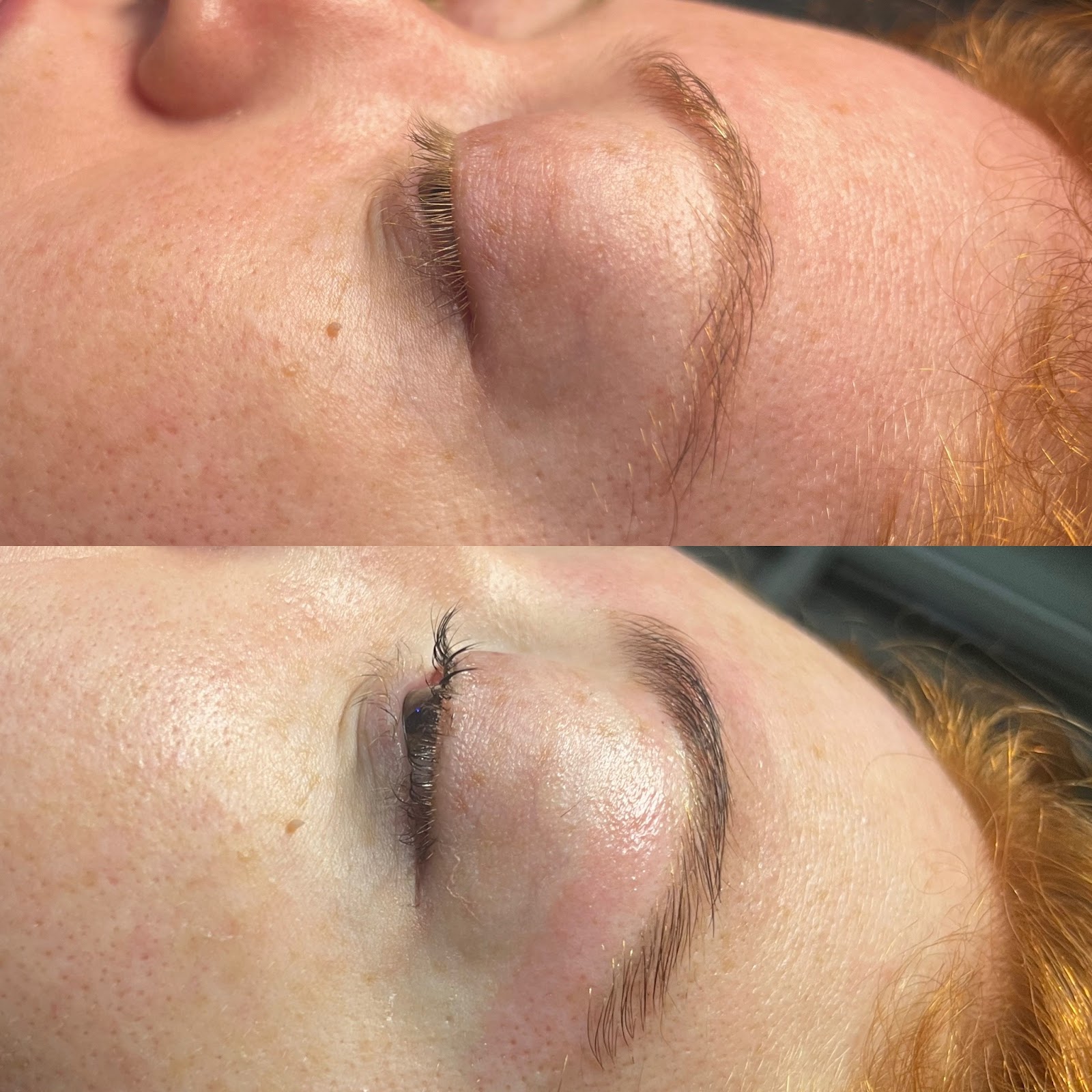 Renew by Richard Day Spa - Beauty Spa in Springfield