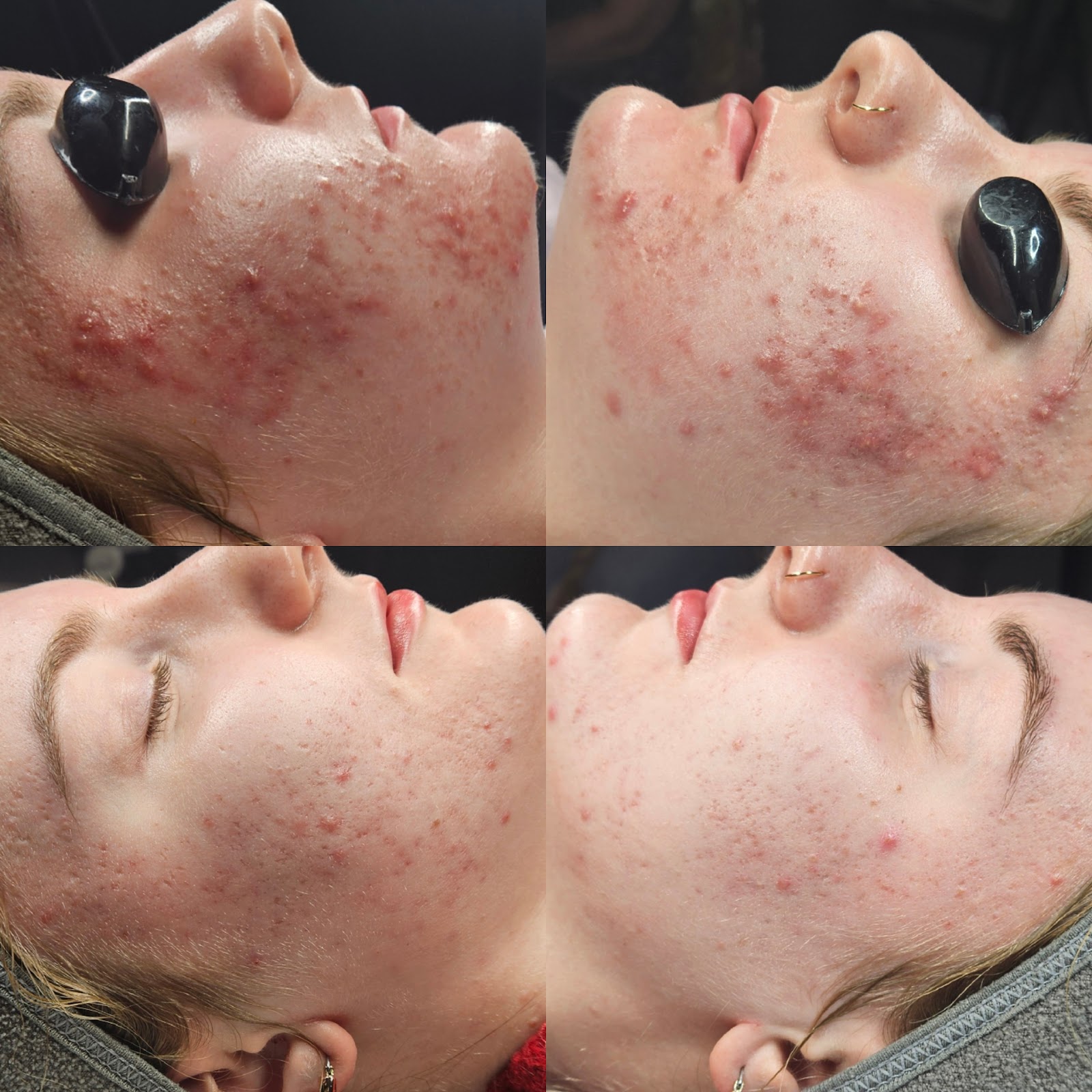 Buffalo Skincare Therapy - Beauty Spa in Buffalo