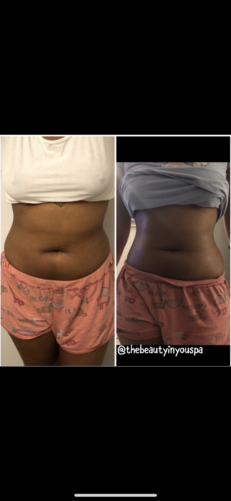 The Beauty In You Spa - Beauty Spa in Raleigh