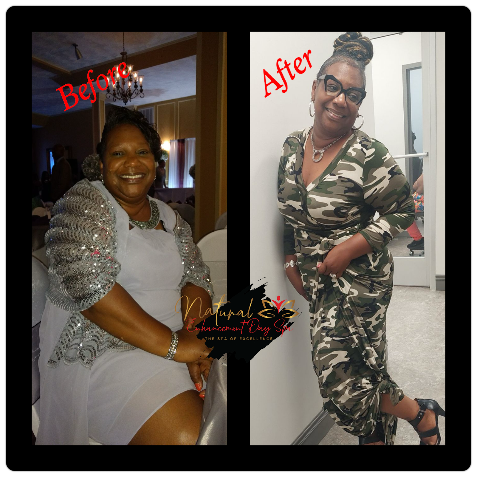 Natural Enhancement Day Spa - Beauty Spa in Greensboro