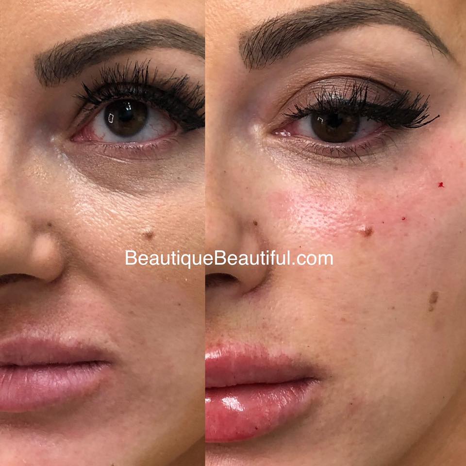 Beautique Medical Anti-Aging - Beauty Spa in Knoxville