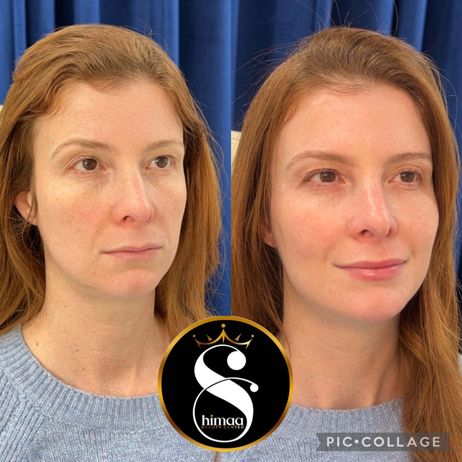 Shimaa Beauty Center Arlington - Hair Salon in Arlington