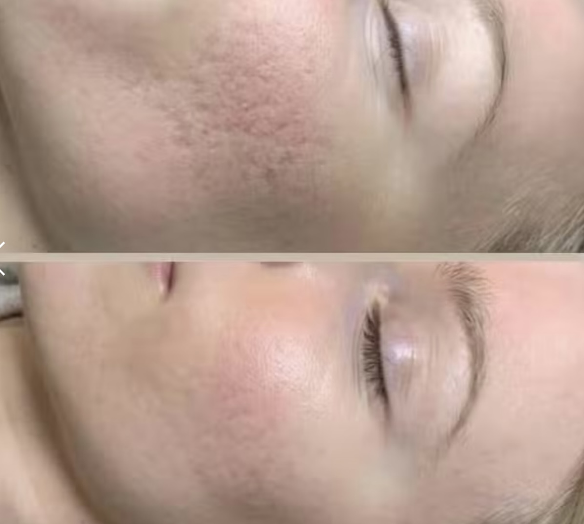 Ageless Beauty Rx - Beauty Spa in Vancouver